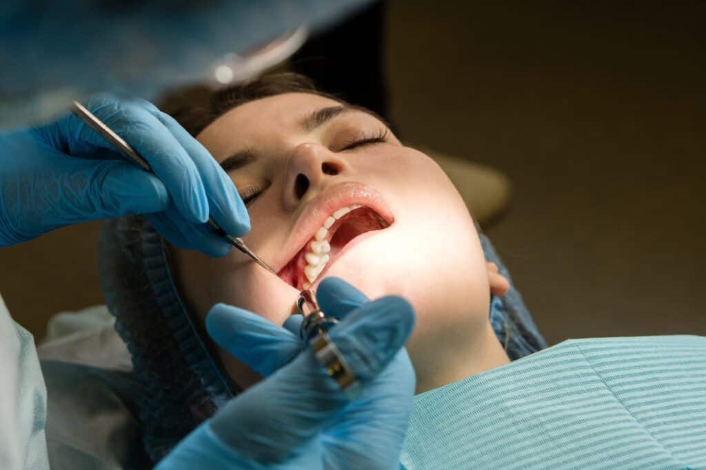 opération en cours d'une patiente pour une extraction des dents de sagesse